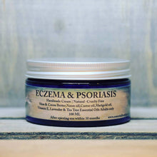 Load image into Gallery viewer, ECZEMA PSORIASIS ROSACEA Handmade Natural Skin Cream with Marigold and Neem oil
