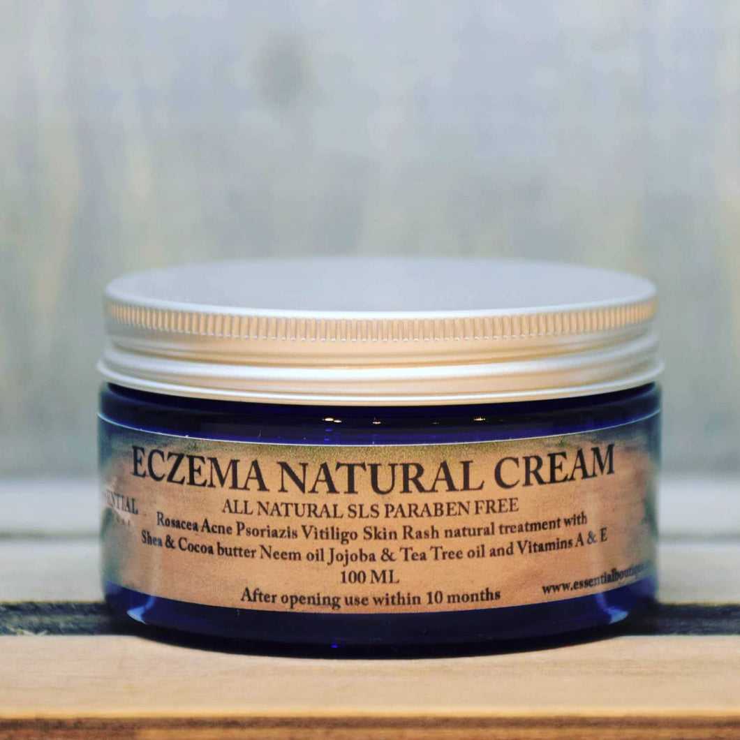 Eczema Natural cream relief Psoriasis Rosacea Prone skin Rash Treatment 100 Ml